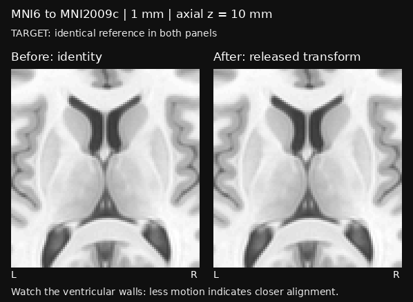 Synchronized blink comparison of ventricular anatomy: left is before alignment, right is after the released transform. Both panels alternate with the same stationary target.