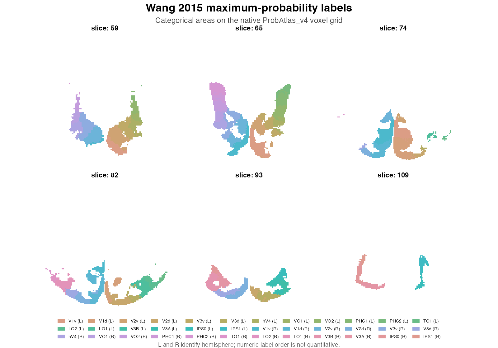 Six tightly cropped axial slices through the Wang maximum-probability maps on their native grid. Visual areas present in each slice have categorical colours and left or right hemisphere labels; zero background is white.
