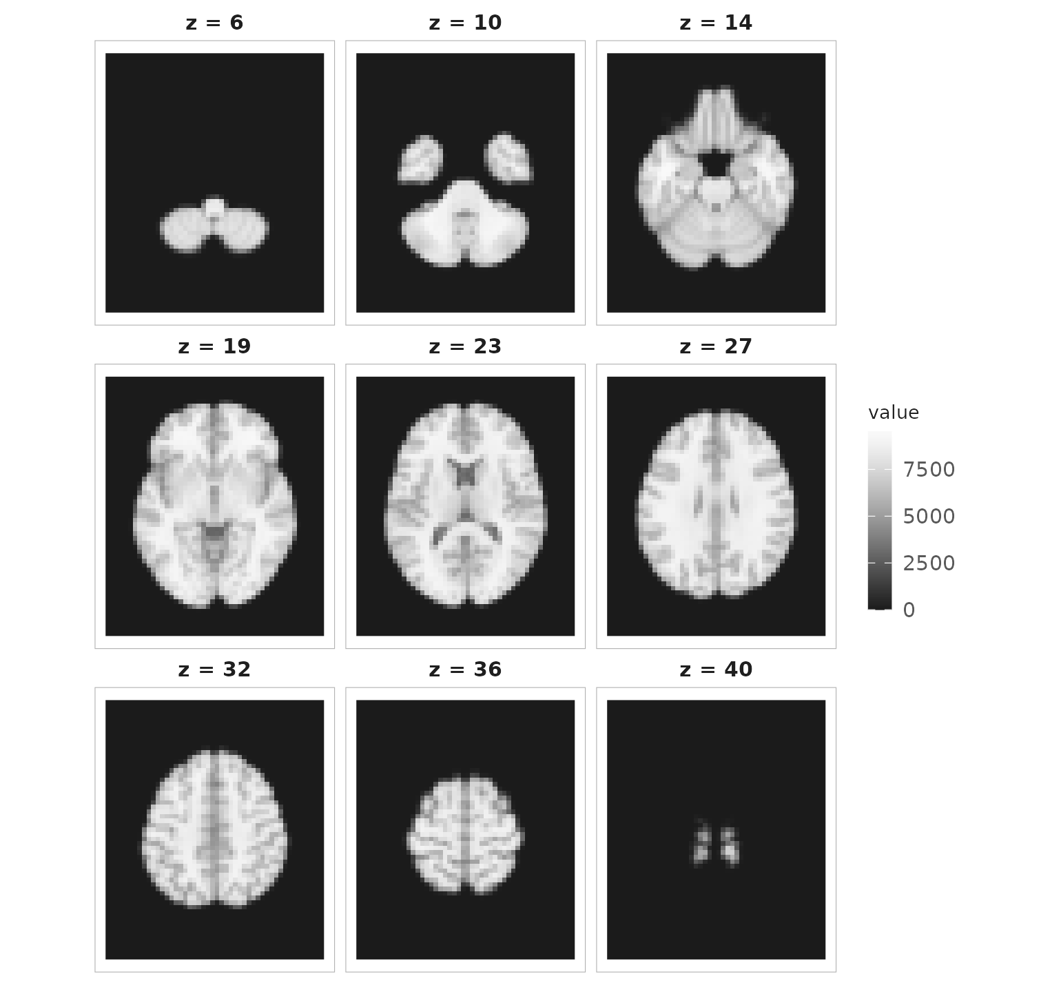 Nine axial slices of an anatomical brain image.