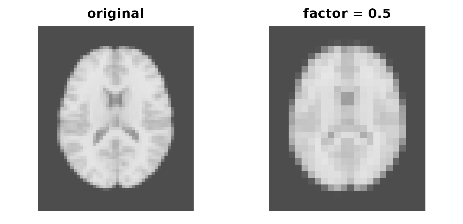 Two axial slices, the second visibly blockier.