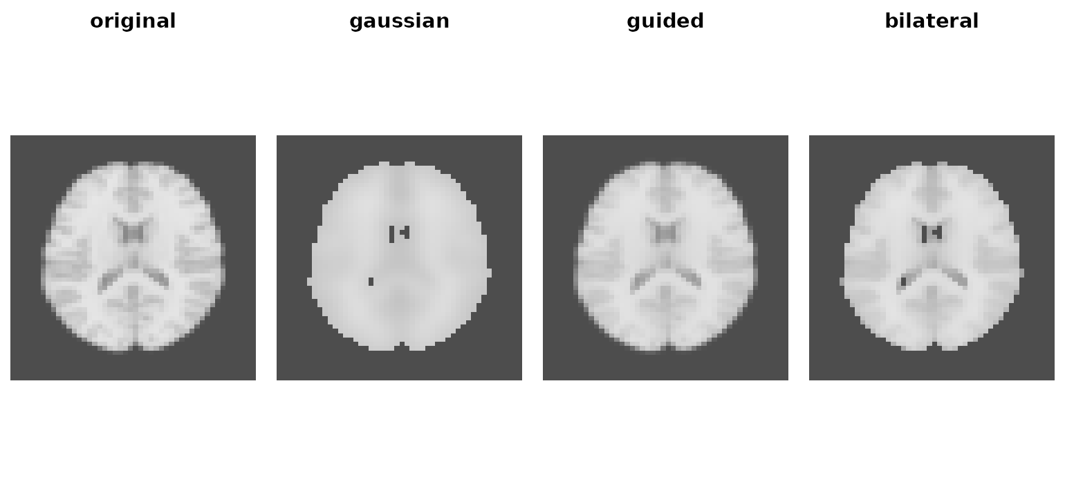 Four axial slices comparing original, Gaussian, guided and bilateral filtering.
