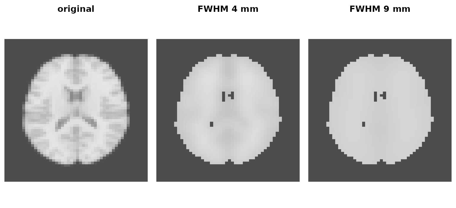 Three axial slices: original, lightly smoothed, heavily smoothed.