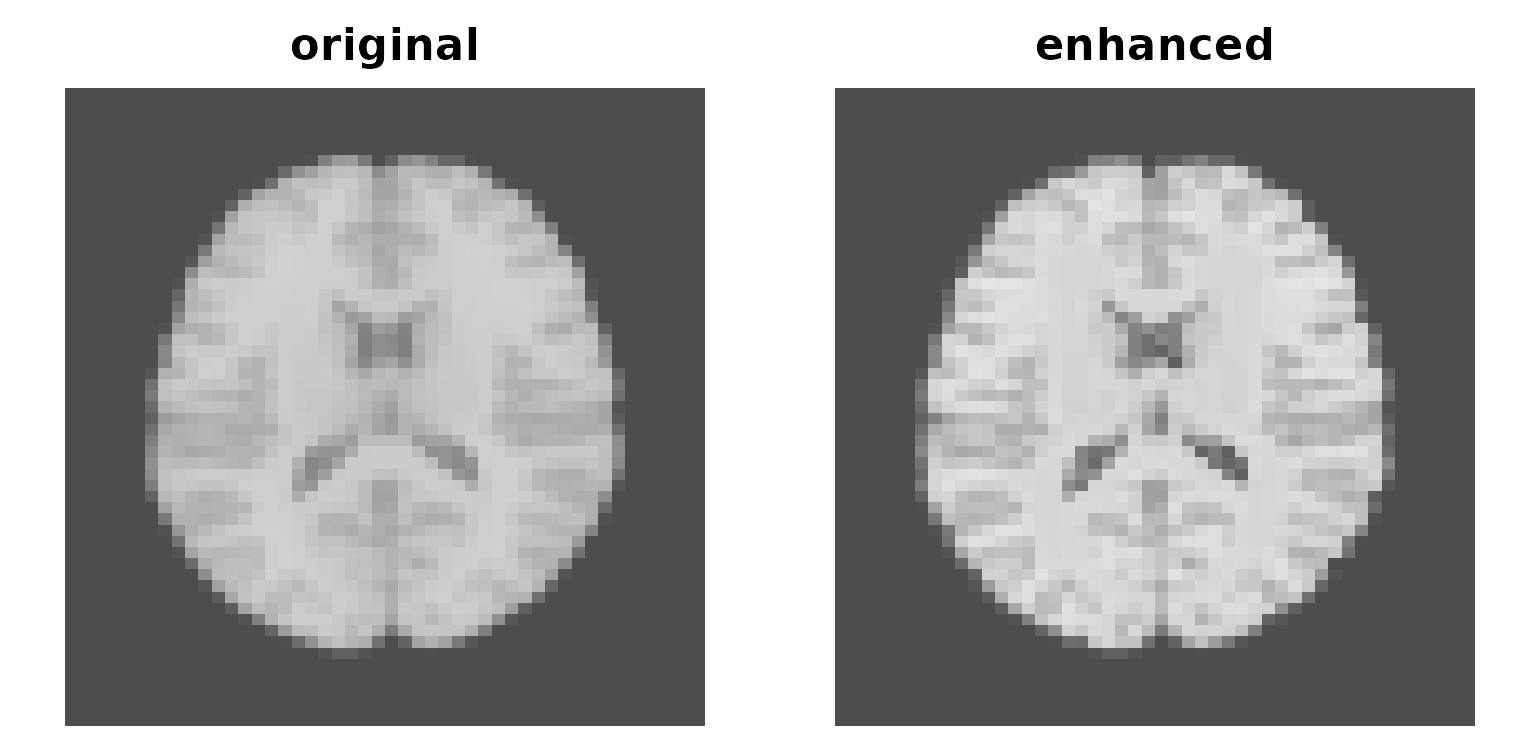 Two axial slices: original and sharpened.