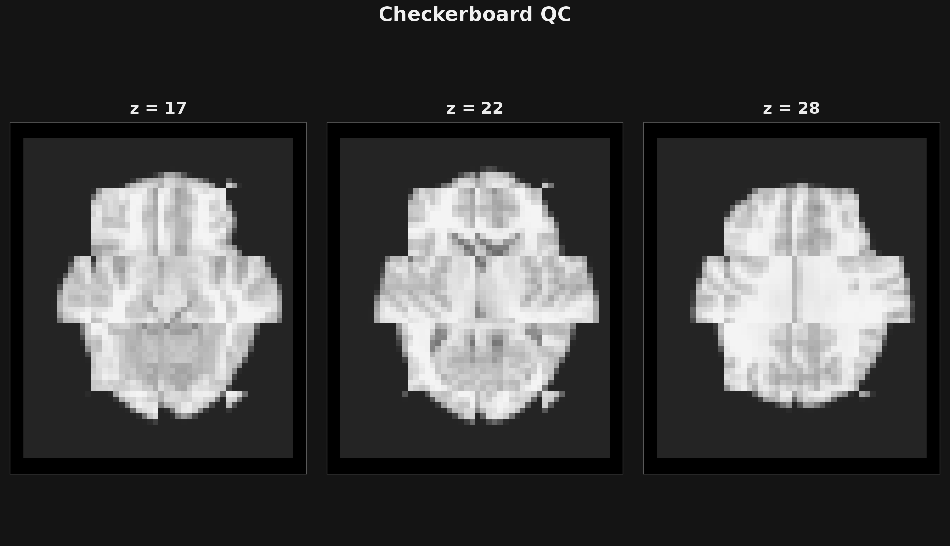 Three large checkerboard slices; brain structures are offset between alternating tiles.