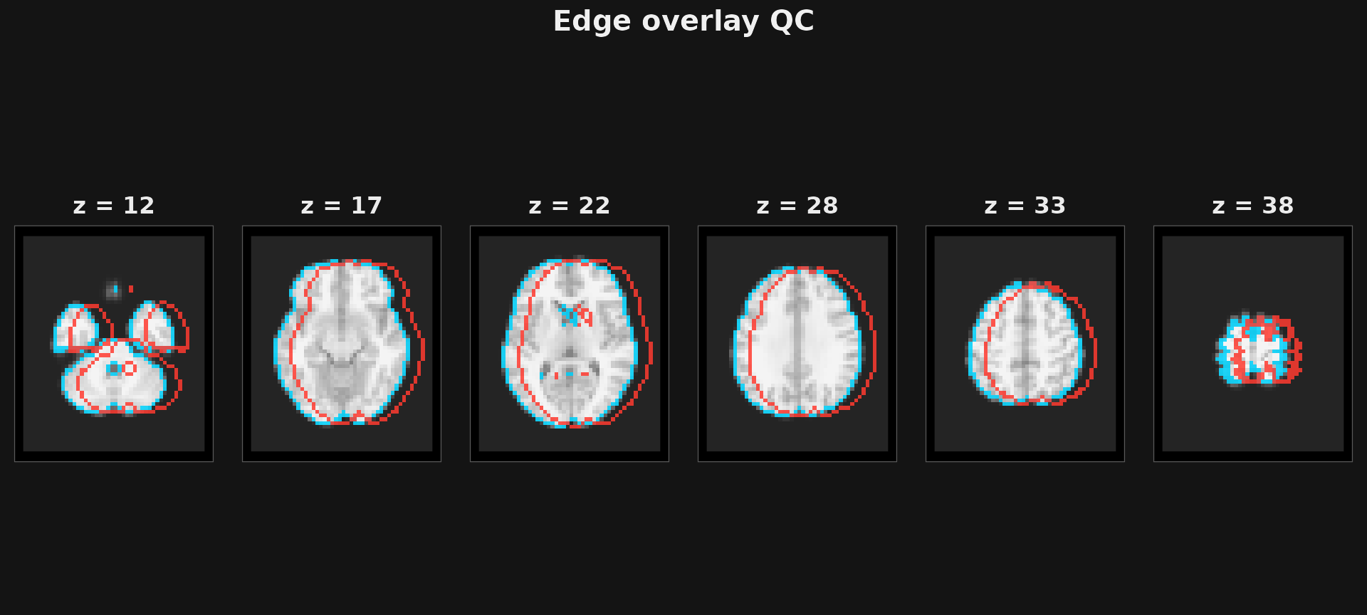 Edge overlay slices with two colours of outline separating.