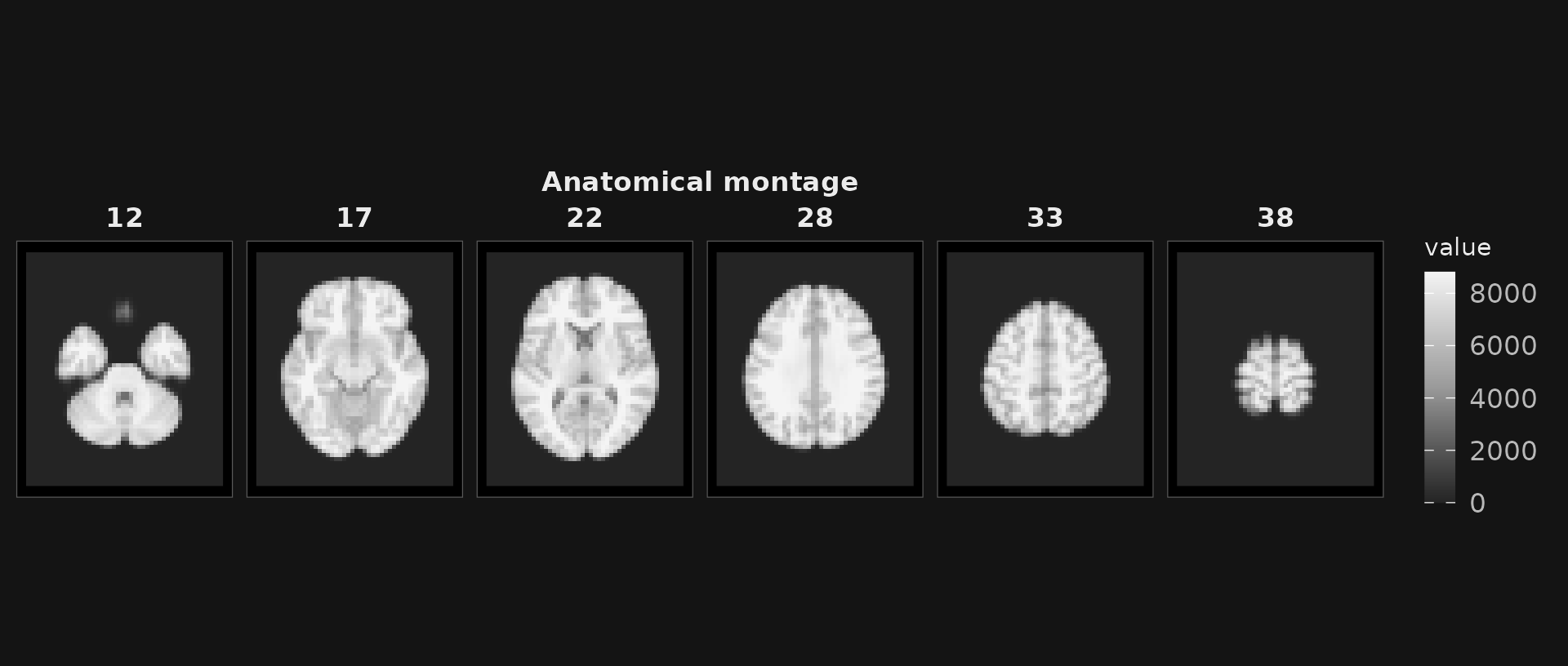Six axial anatomical slices on a dark background.