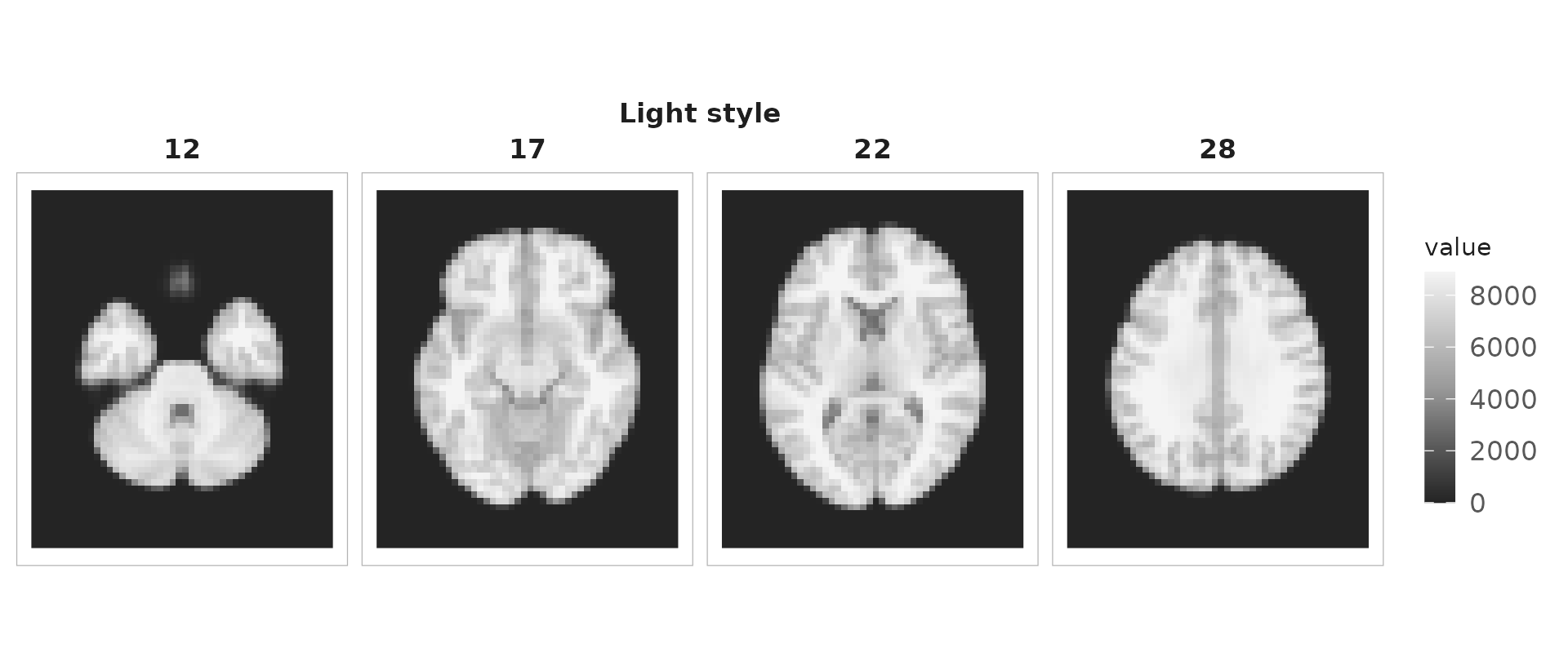 Four axial anatomical slices, dark brain tiles on a light page.