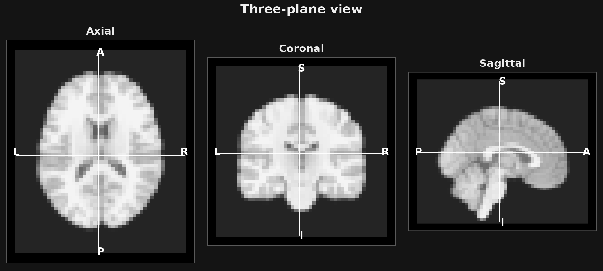 Three orthogonal slices with crosshairs.