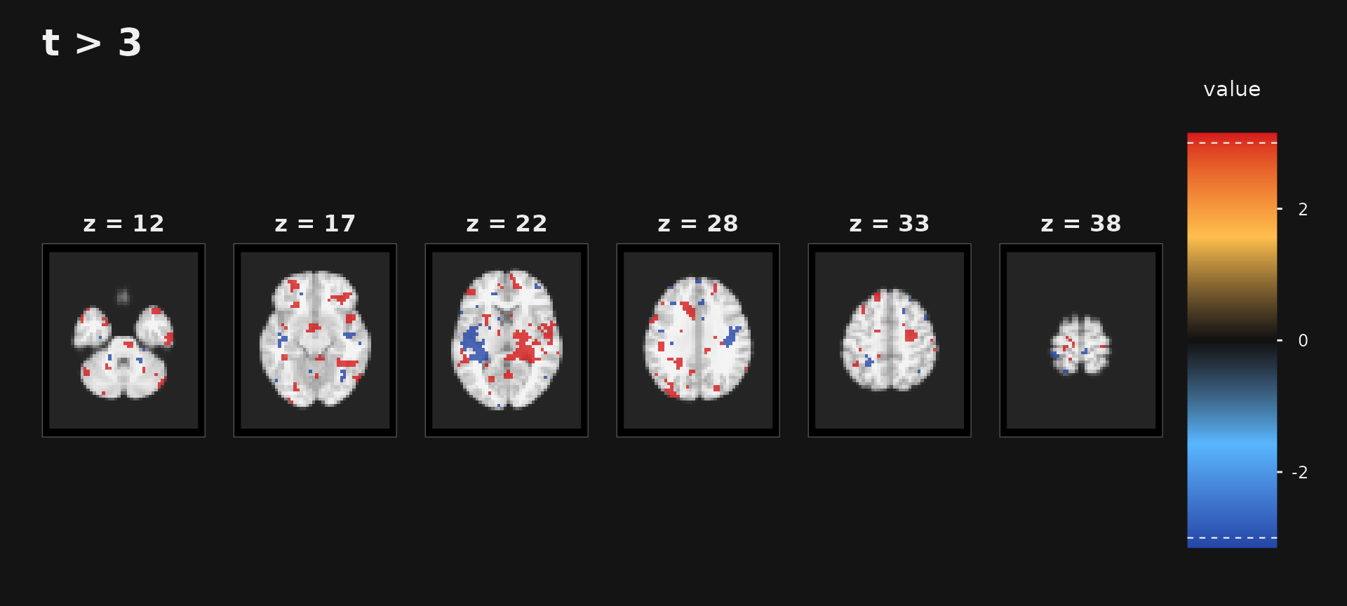 Six anatomical slices with blue and orange statistical clusters.