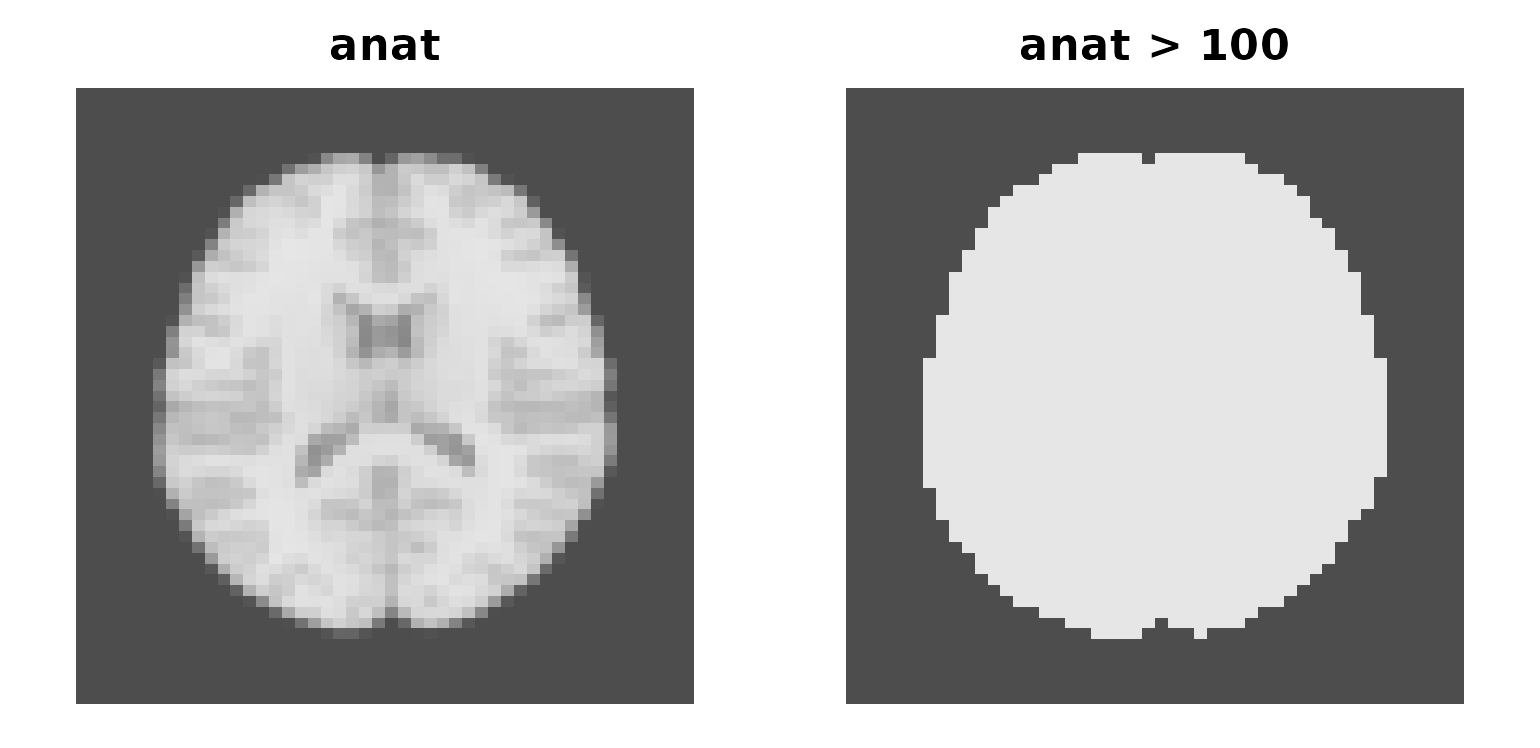 Two axial slices side by side: an anatomical slice and its binary mask.