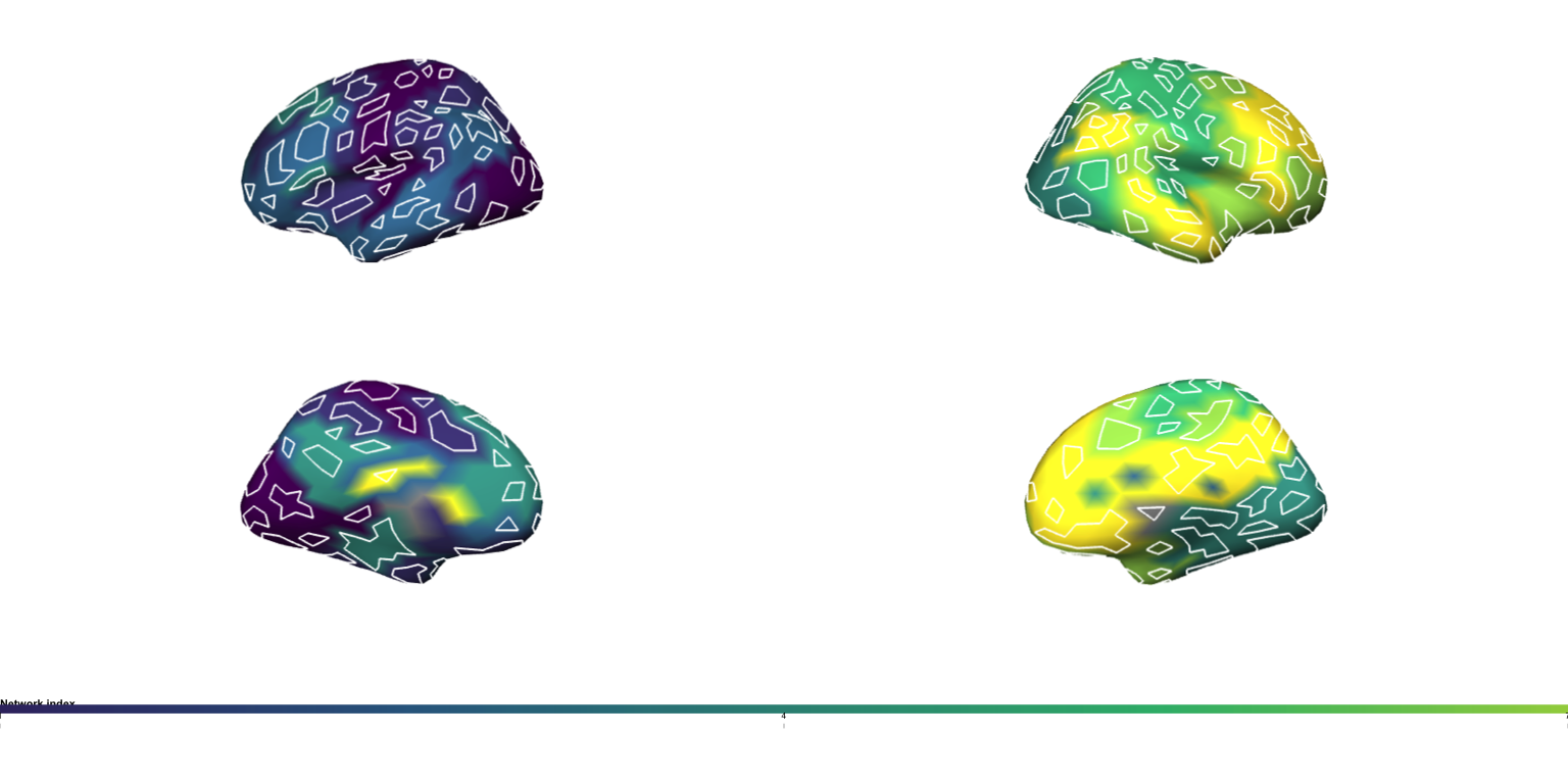 Lateral and medial views of left and right fsaverage surfaces with network colours and parcel outlines